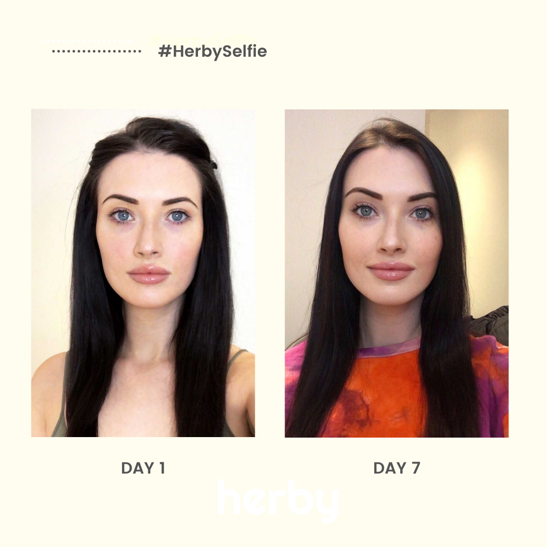 See what 7 days can do #HerbySelfie